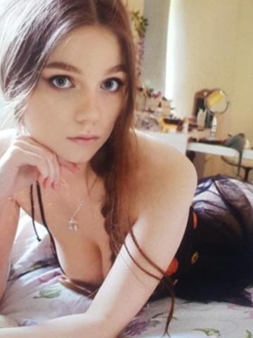 Альбина